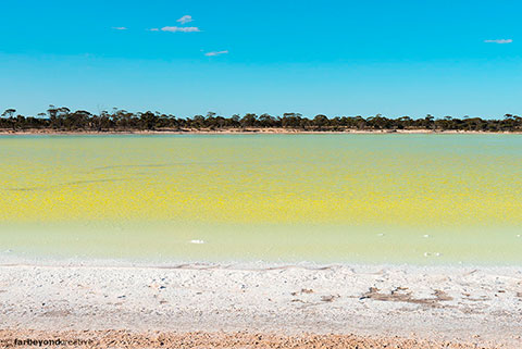 20151125_8949